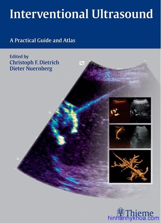 Interventional Ultrasound: A Practical Guide and Atlas Dieter Nurnberg