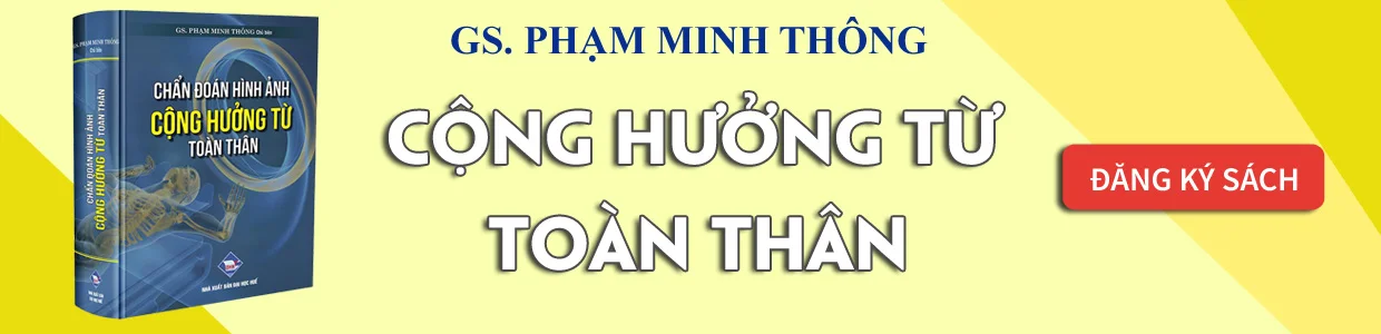 MRI toan than