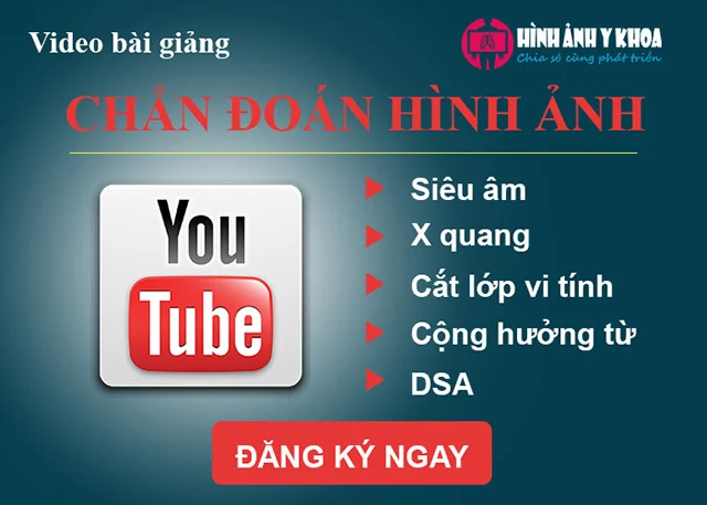 Kênh Youtube Hình ảnh Y khoa