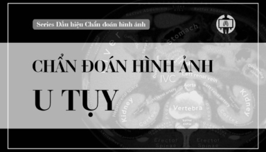 chan doan hinh anh u tuy cap nhat