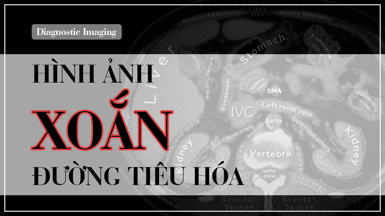 Hinh anh xoan duong tieu hoa