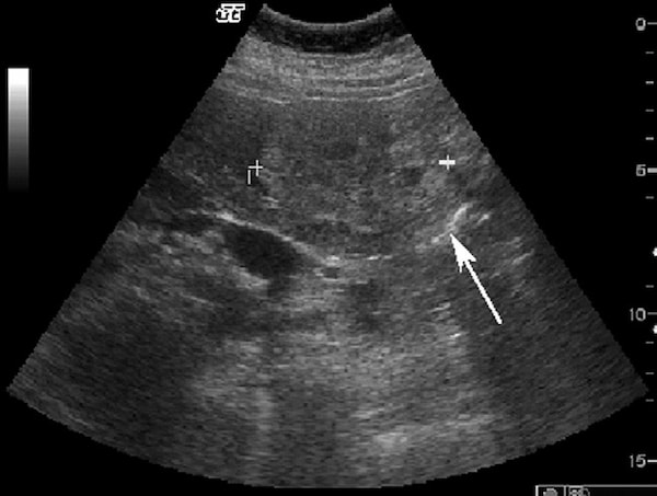 Cac Ton Thuong Gan Khu Tru Giau Mach Mau - Hinh 01