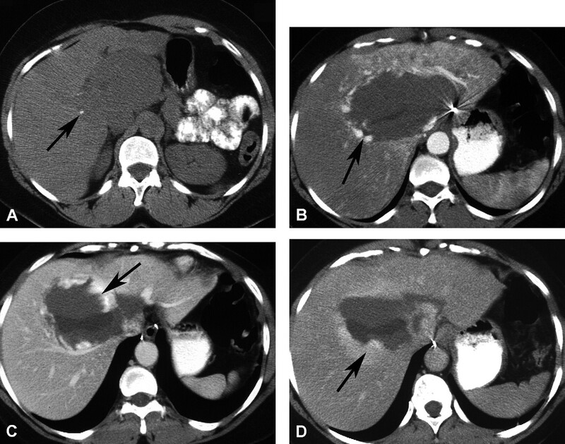 Cac Ton Thuong Gan Khu Tru Giau Mach Mau - Hinh 02