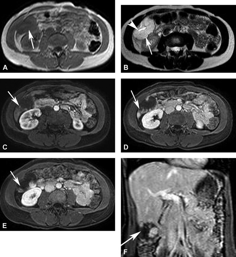 Cac Ton Thuong Gan Khu Tru Giau Mach Mau - Hinh 05