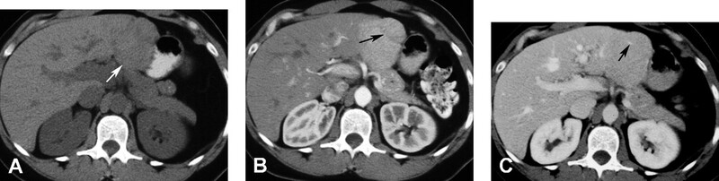 Cac Ton Thuong Gan Khu Tru Giau Mach Mau - Hinh 06