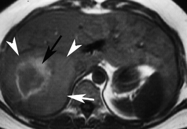 Cac Ton Thuong Gan Khu Tru Giau Mach Mau - Hinh 09