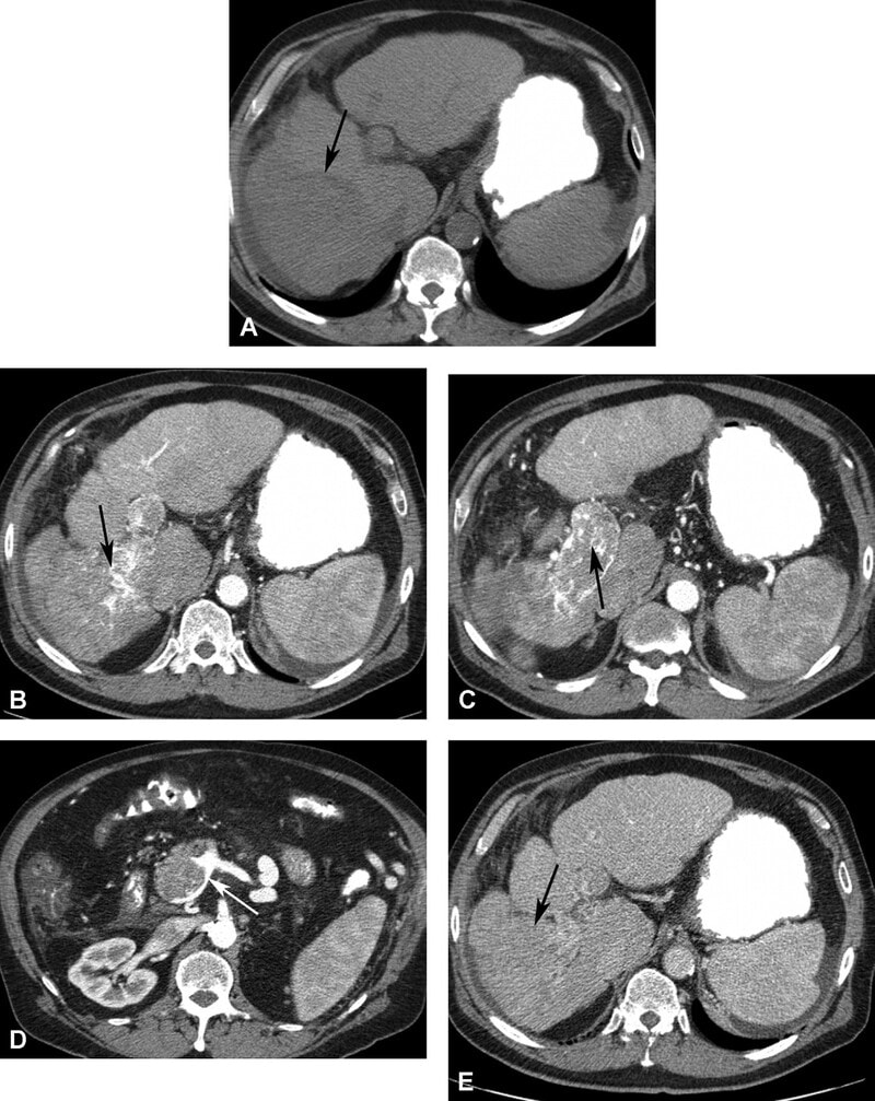 Cac Ton Thuong Gan Khu Tru Giau Mach Mau - Hinh 10