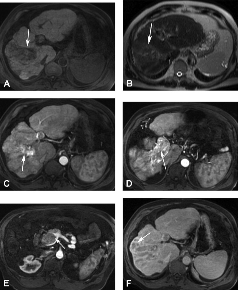 Cac Ton Thuong Gan Khu Tru Giau Mach Mau - Hinh 11