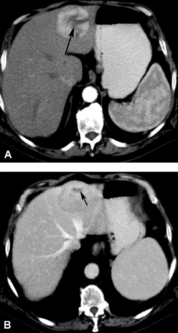 Cac Ton Thuong Gan Khu Tru Giau Mach Mau - Hinh 12