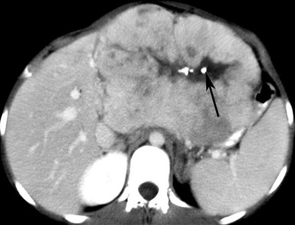 Cac Ton Thuong Gan Khu Tru Giau Mach Mau - Hinh 13