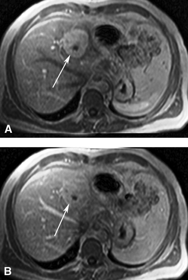 Cac Ton Thuong Gan Khu Tru Giau Mach Mau - Hinh 14
