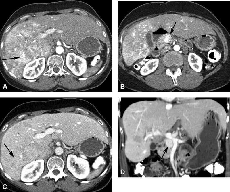 Cac Ton Thuong Gan Khu Tru Giau Mach Mau - Hinh 16