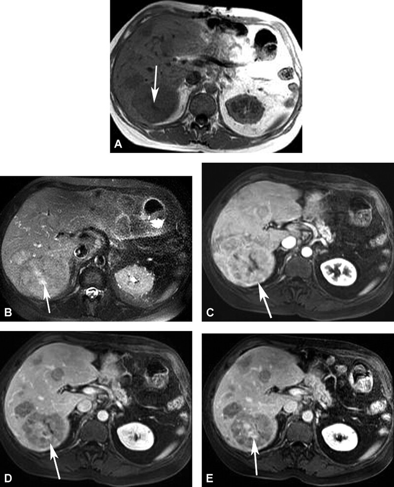 Cac Ton Thuong Gan Khu Tru Giau Mach Mau - Hinh 17