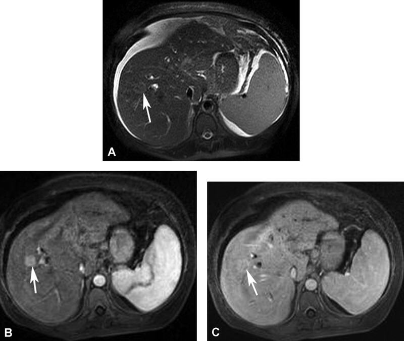 Cac Ton Thuong Gan Khu Tru Giau Mach Mau - Hinh 18