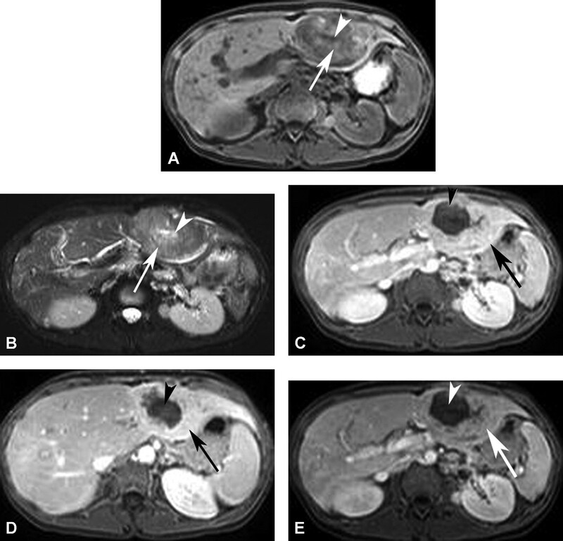 Cac Ton Thuong Gan Khu Tru Giau Mach Mau - Hinh 19