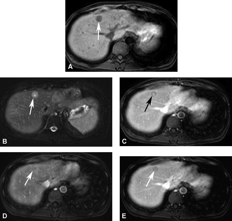 Cac Ton Thuong Gan Khu Tru Giau Mach Mau - Hinh 20