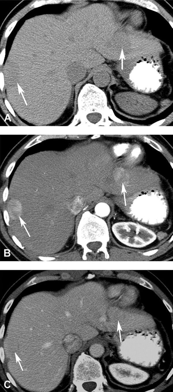 Cac Ton Thuong Gan Khu Tru Giau Mach Mau - Hinh 21