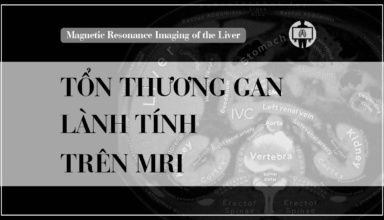 Mri Gan Ton Thuong Lanh Tinh