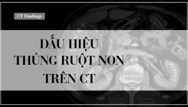 CT thung ruot non