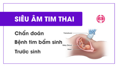 Sieu-am-tim-thai-trong-chan-doan-benh-tim-bam-sinh