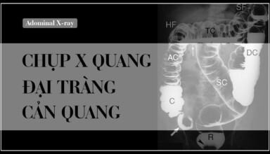 Chup X quang dai truc trang can quang