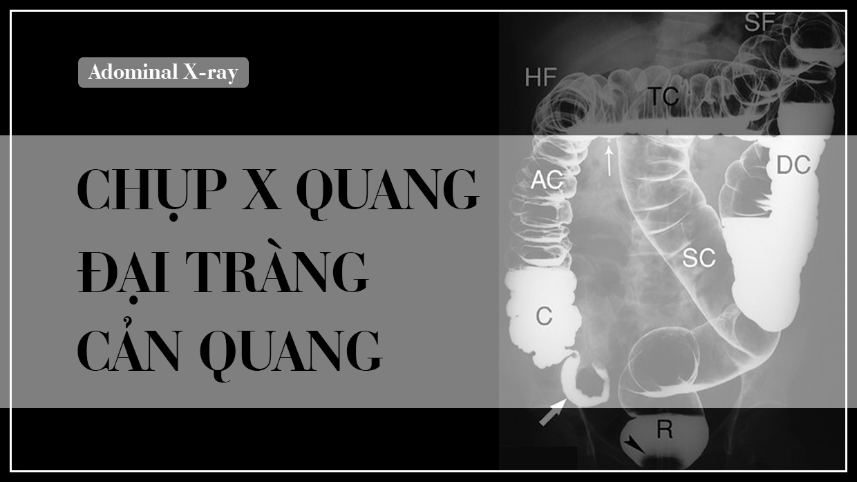 Chup X quang dai truc trang can quang