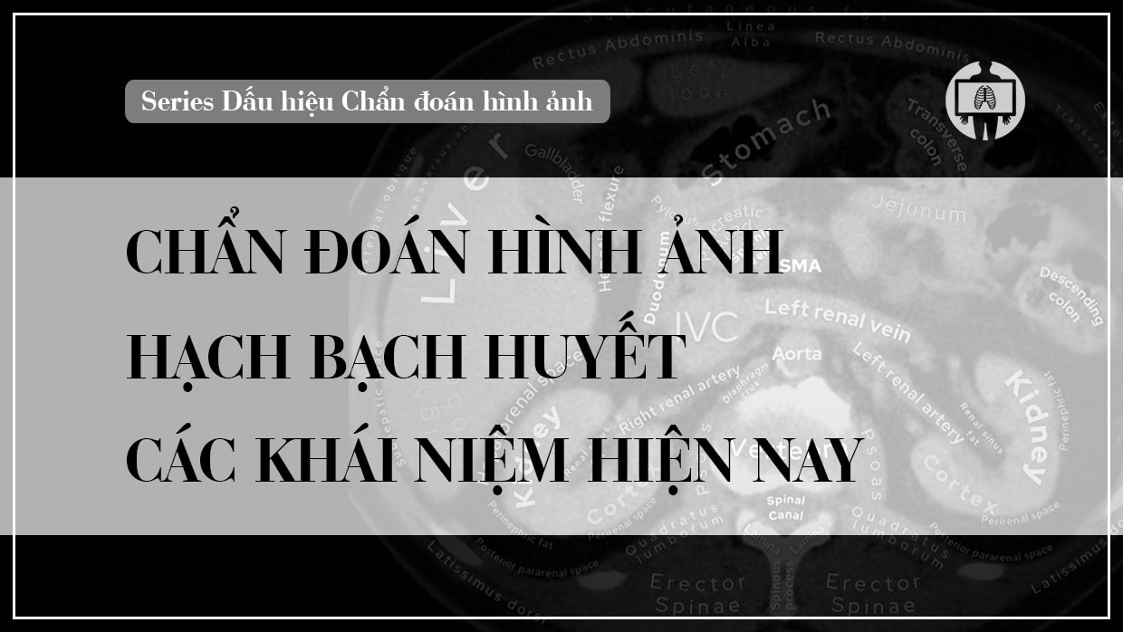 chan doan hinh anh hach bach huyet
