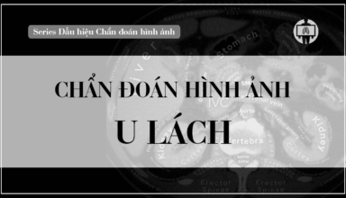chan doan hinh anh u lach