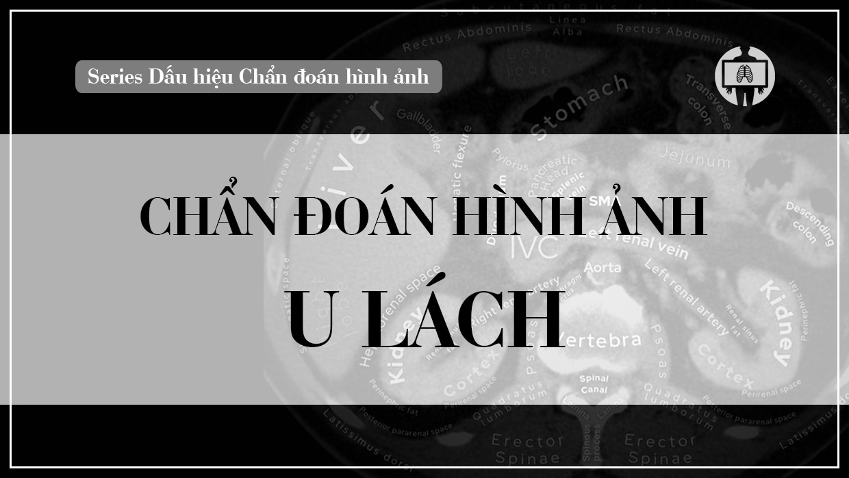 chan doan hinh anh u lach