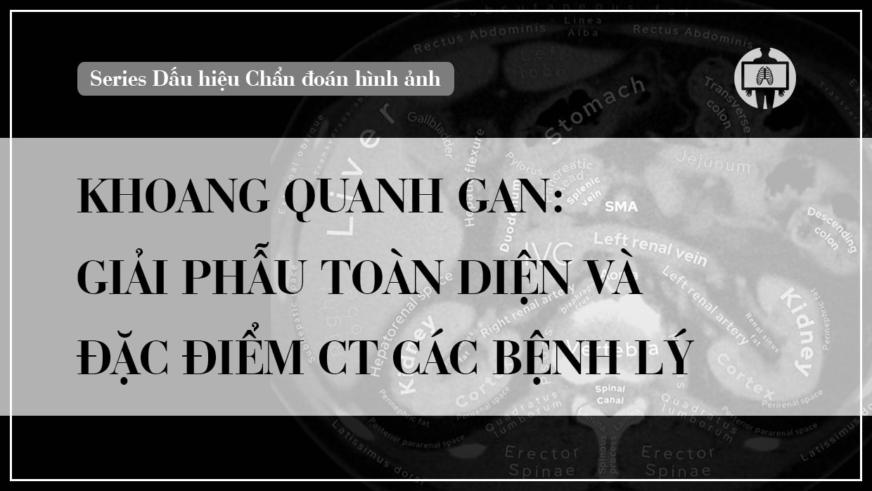khoang-quanh-gan