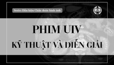 phim uiv