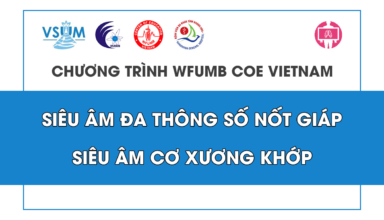 CME Sieu am da thong so giap va sieu am co xuong khop 2024