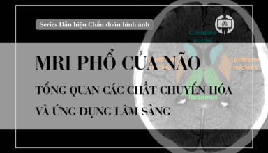 Cong huong tu pho nao