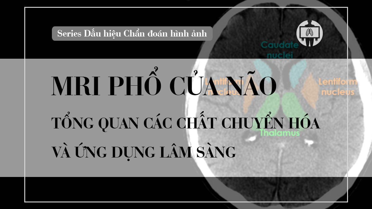 Cong huong tu pho nao