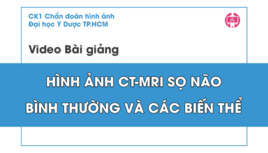 Hinh anh CT-MRI so nao binh thuong va cac bien the