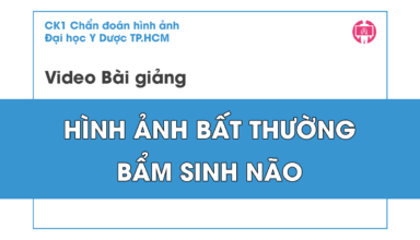 Hinh anh bat thuong bam sinh nao
