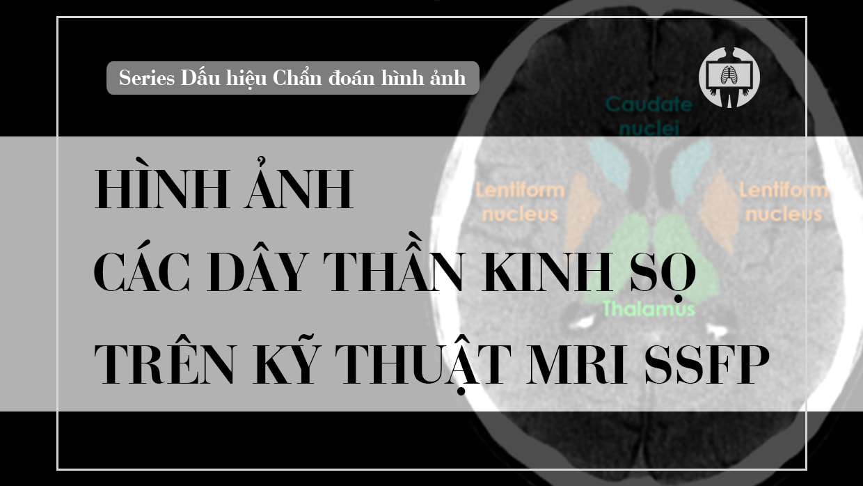 Hinh anh cac day than kinh so tren mri ssfp