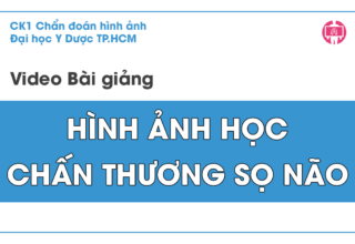 Hinh anh hoc chan thuong so nao