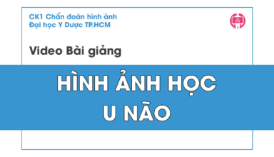 Hinh anh hoc u nao