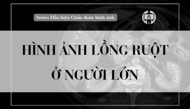Hinh anh long ruot o nguoi lon