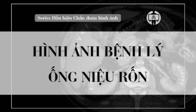 hinh anh benh ly ong nieu ron