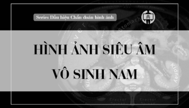 hinh anh sieu am trong vo sinh nam