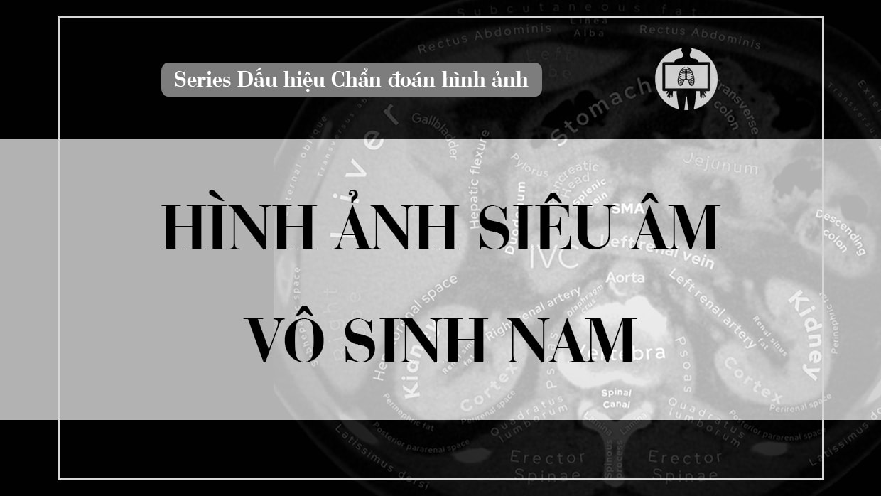 hinh anh sieu am trong vo sinh nam
