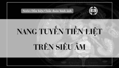 nang tuyen tien liet tren sieu am