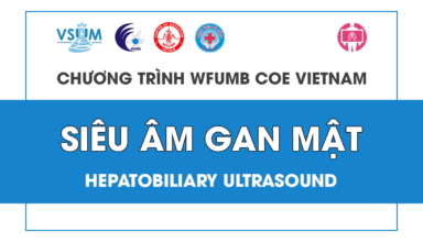 CME Sieu am gan mat 2023