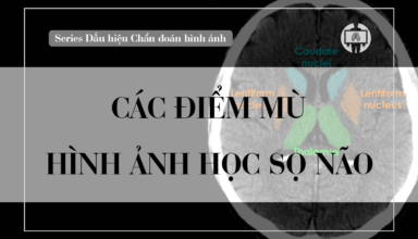 Cac diem mu hinh anh hoc so nao
