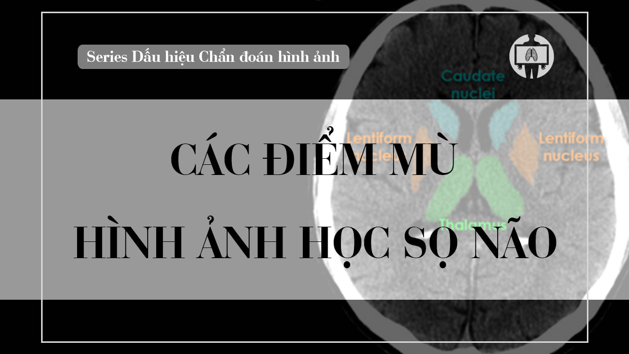 Cac diem mu hinh anh hoc so nao