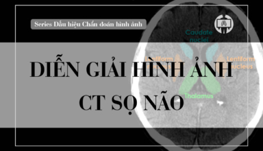 Dien giai hinh anh CT so nao