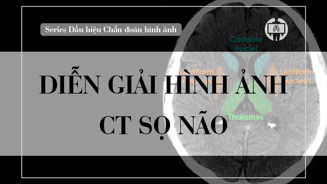 Dien giai hinh anh CT so nao