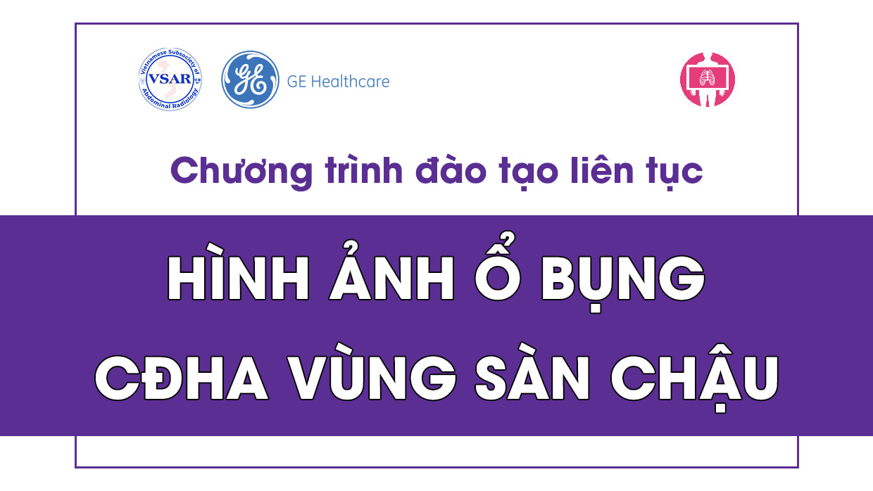 CME CDHA vung san chau